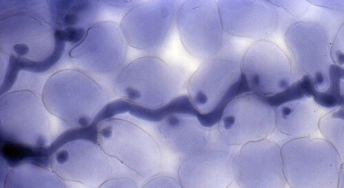 Hyaloperonospora arabidopsidis